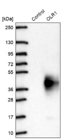 LOX-1/OLR1 Antibody, Novus Biologicals 100 &mu;L | Buy Online | Novus Biologicals | Fisher Scientific